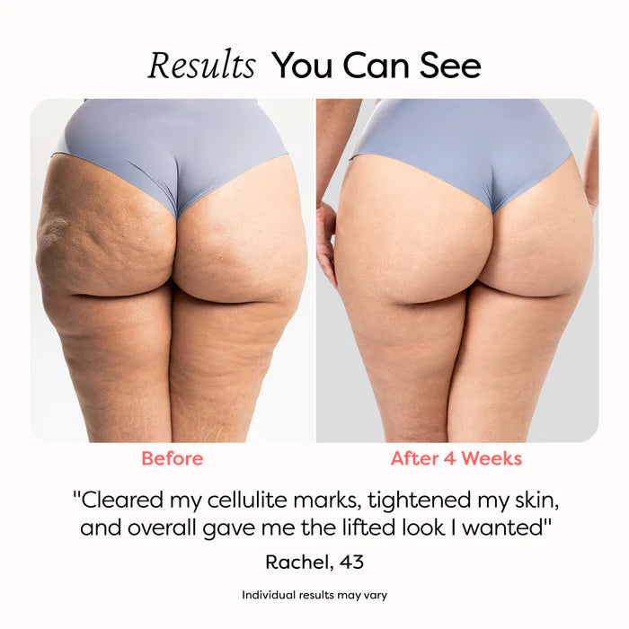 Anti-Cellulite Massage Oil